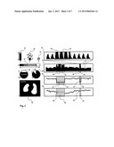 ELECTRICAL IMPEDANCE TOMOGRAPHY DEVICE AND PROCESS diagram and image