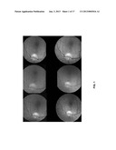 CALIBRATION DEVICE FOR USE WITH A FUNDUS CAMERA diagram and image