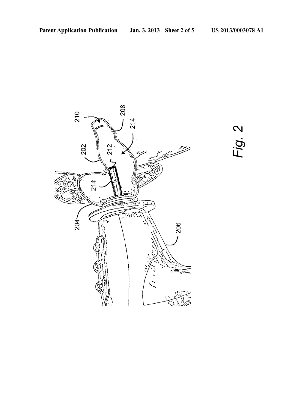 THREE DIMENSIONAL SCANNING USING MEMBRANE WITH OPTICAL FEATURES - diagram, schematic, and image 03