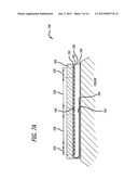 Zero-Heat-Flux, Deep Tissue Temperature Measurement Devices with Thermal     Sensor Calibration diagram and image