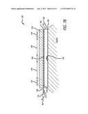 Zero-Heat-Flux, Deep Tissue Temperature Measurement Devices with Thermal     Sensor Calibration diagram and image