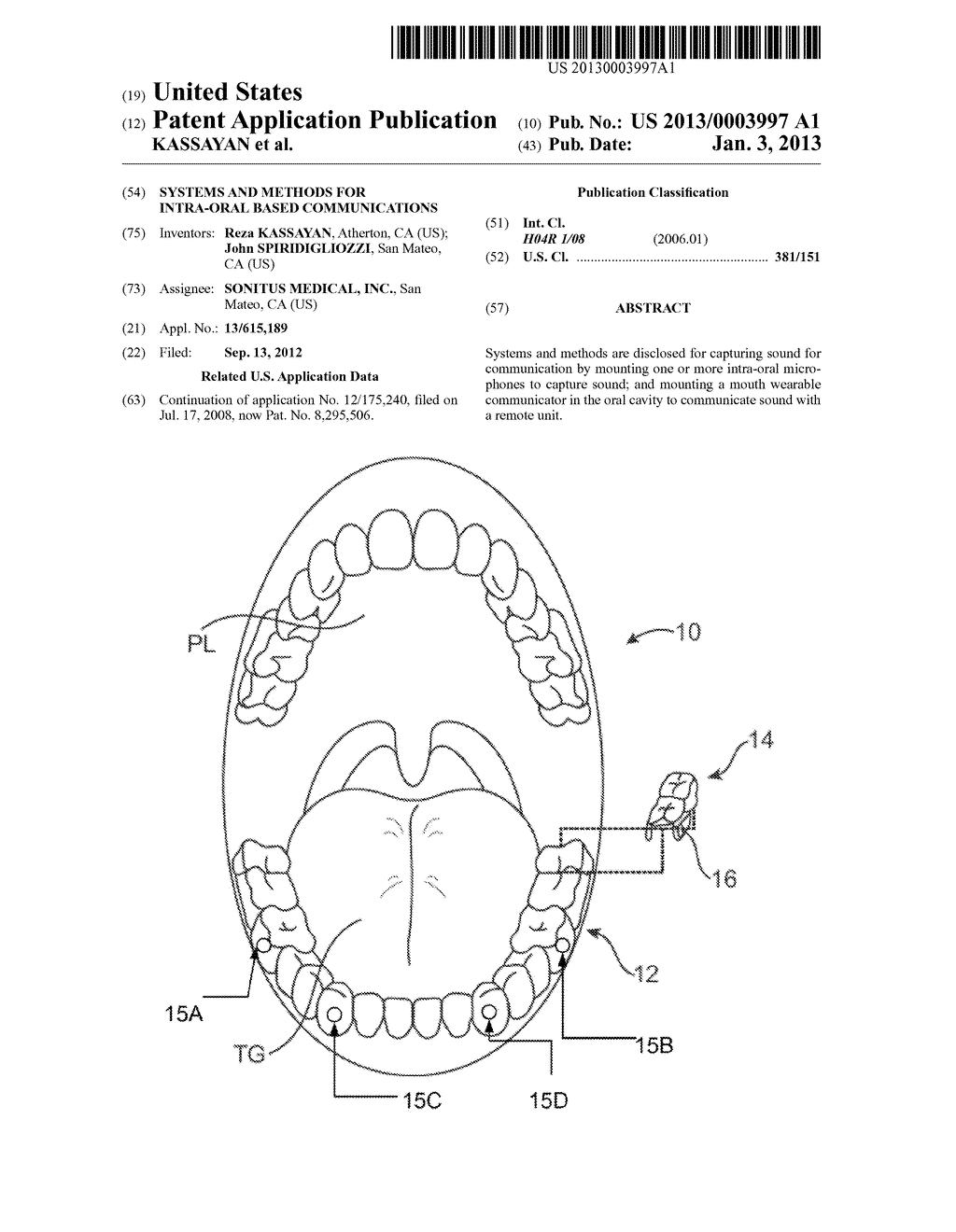 SYSTEMS AND METHODS FOR INTRA-ORAL BASED COMMUNICATIONS - diagram, schematic, and image 01