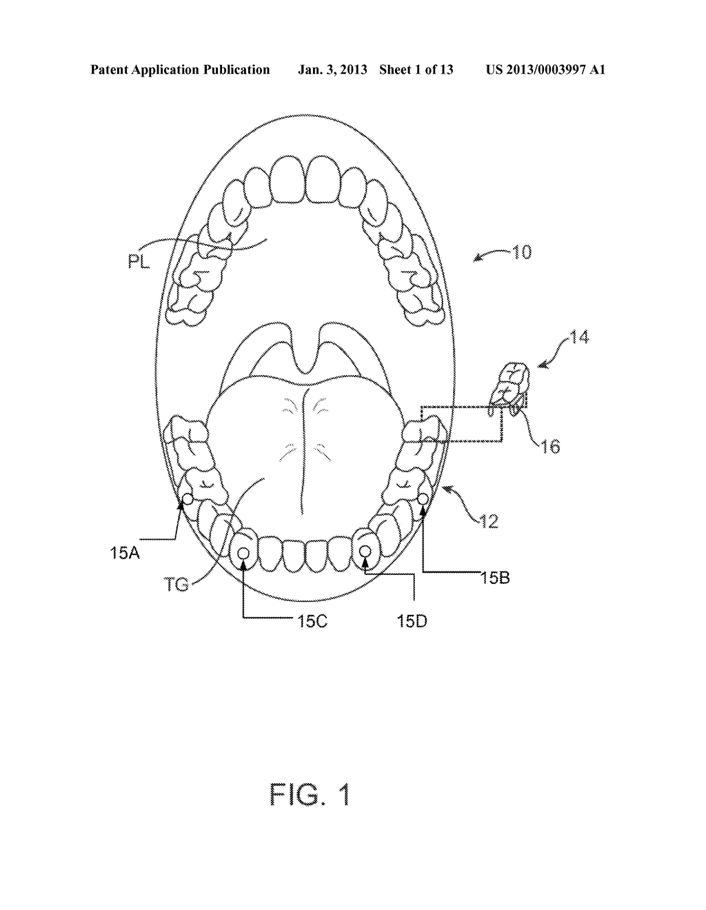 SYSTEMS AND METHODS FOR INTRA-ORAL BASED COMMUNICATIONS - diagram, schematic, and image 02