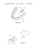 SYSTEMS AND METHODS FOR INTRA-ORAL BASED COMMUNICATIONS diagram and image