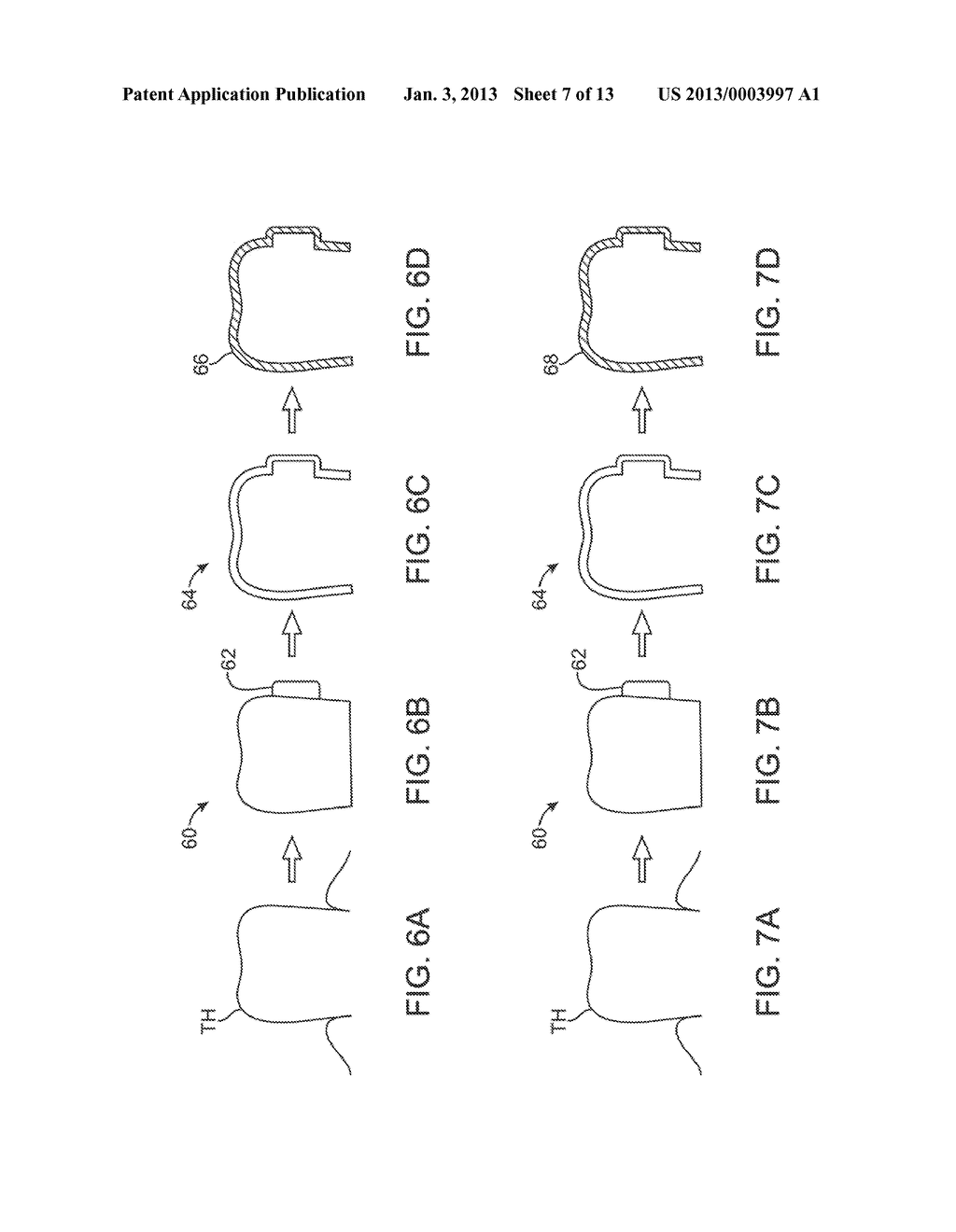 SYSTEMS AND METHODS FOR INTRA-ORAL BASED COMMUNICATIONS - diagram, schematic, and image 08