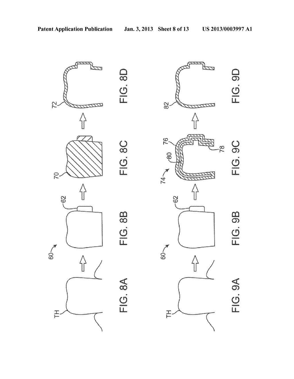 SYSTEMS AND METHODS FOR INTRA-ORAL BASED COMMUNICATIONS - diagram, schematic, and image 09