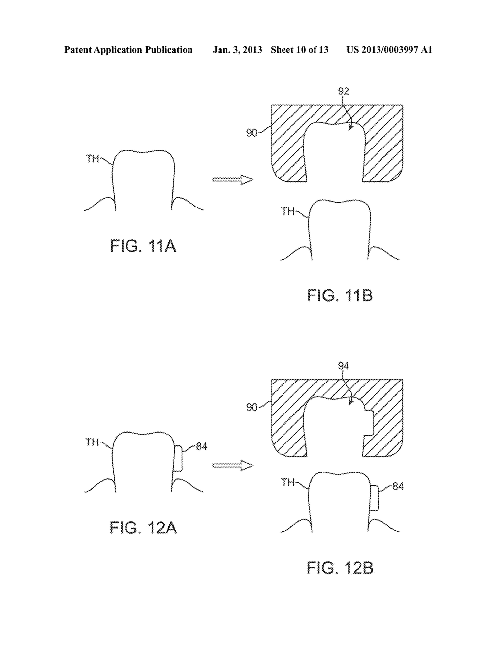 SYSTEMS AND METHODS FOR INTRA-ORAL BASED COMMUNICATIONS - diagram, schematic, and image 11