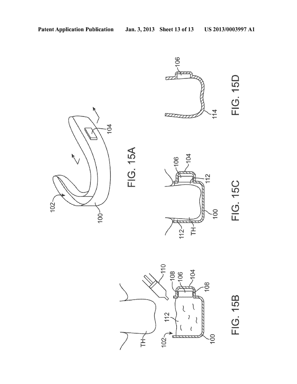 SYSTEMS AND METHODS FOR INTRA-ORAL BASED COMMUNICATIONS - diagram, schematic, and image 14