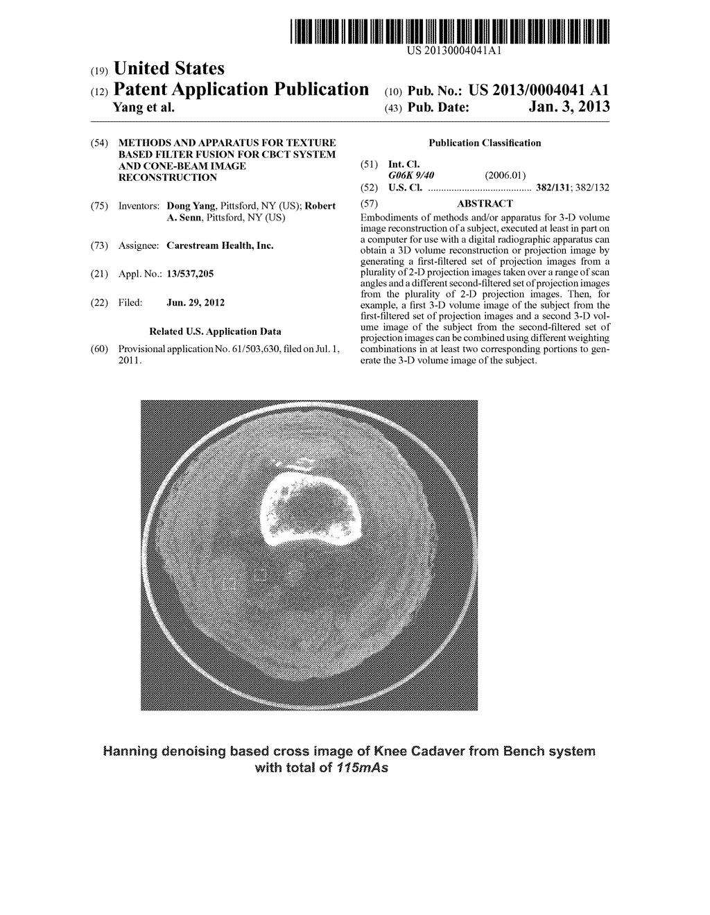 METHODS AND APPARATUS FOR TEXTURE BASED FILTER FUSION FOR CBCT SYSTEM AND     CONE-BEAM IMAGE RECONSTRUCTION - diagram, schematic, and image 01