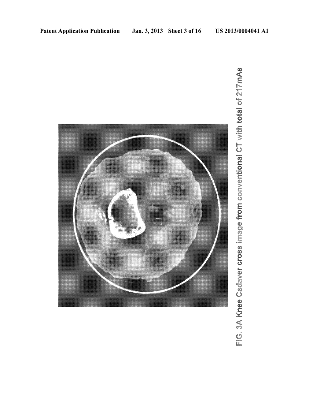 METHODS AND APPARATUS FOR TEXTURE BASED FILTER FUSION FOR CBCT SYSTEM AND     CONE-BEAM IMAGE RECONSTRUCTION - diagram, schematic, and image 04