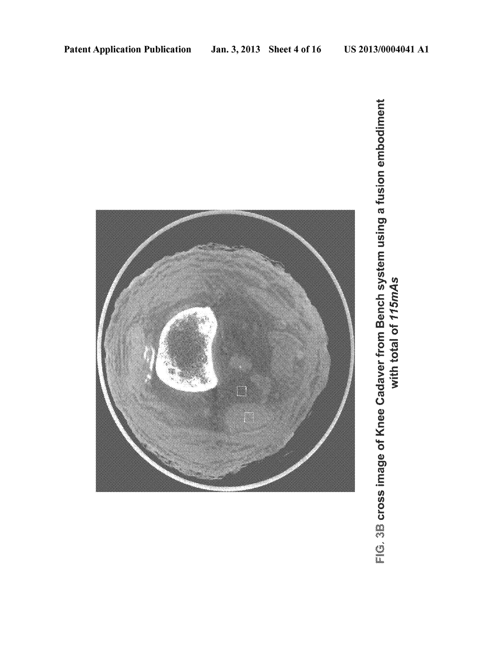 METHODS AND APPARATUS FOR TEXTURE BASED FILTER FUSION FOR CBCT SYSTEM AND     CONE-BEAM IMAGE RECONSTRUCTION - diagram, schematic, and image 05