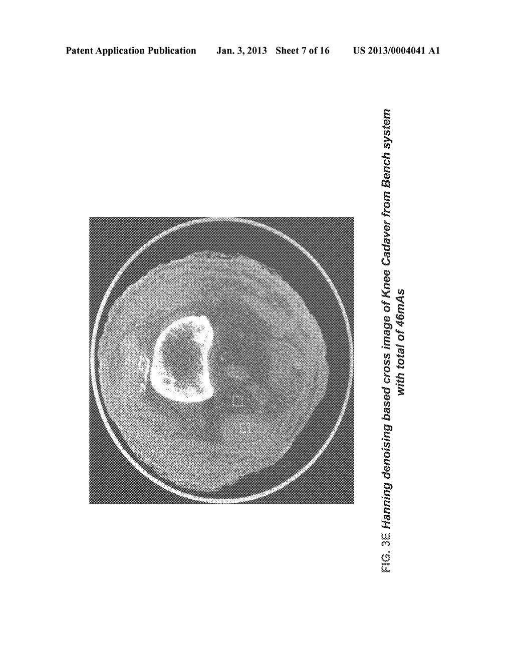 METHODS AND APPARATUS FOR TEXTURE BASED FILTER FUSION FOR CBCT SYSTEM AND     CONE-BEAM IMAGE RECONSTRUCTION - diagram, schematic, and image 08