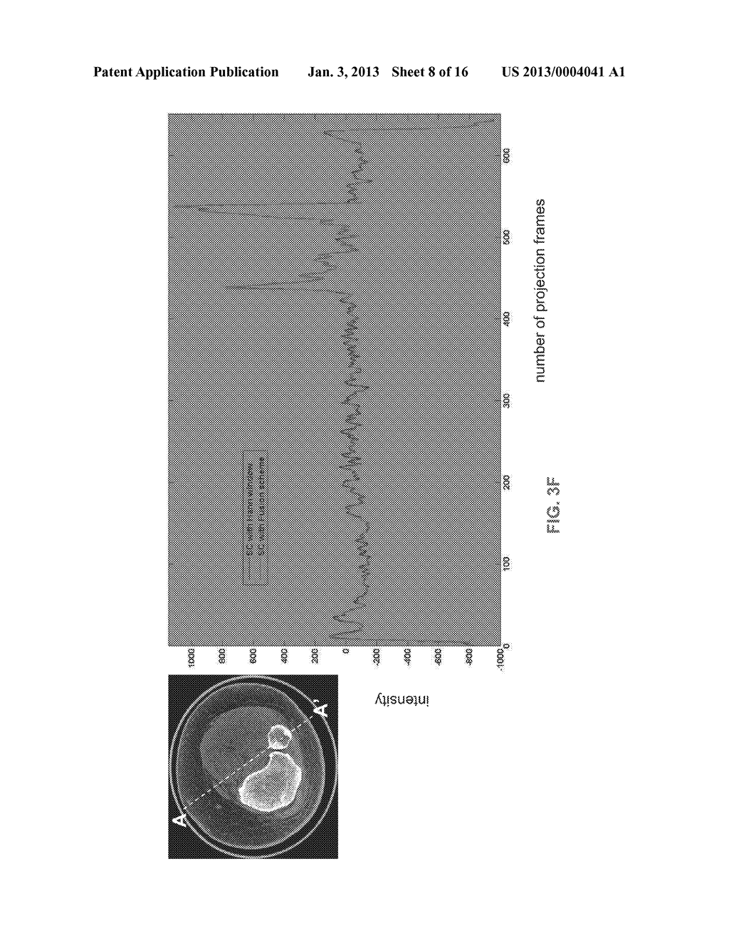 METHODS AND APPARATUS FOR TEXTURE BASED FILTER FUSION FOR CBCT SYSTEM AND     CONE-BEAM IMAGE RECONSTRUCTION - diagram, schematic, and image 09