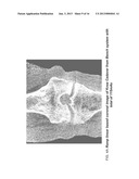 METHODS AND APPARATUS FOR TEXTURE BASED FILTER FUSION FOR CBCT SYSTEM AND     CONE-BEAM IMAGE RECONSTRUCTION diagram and image