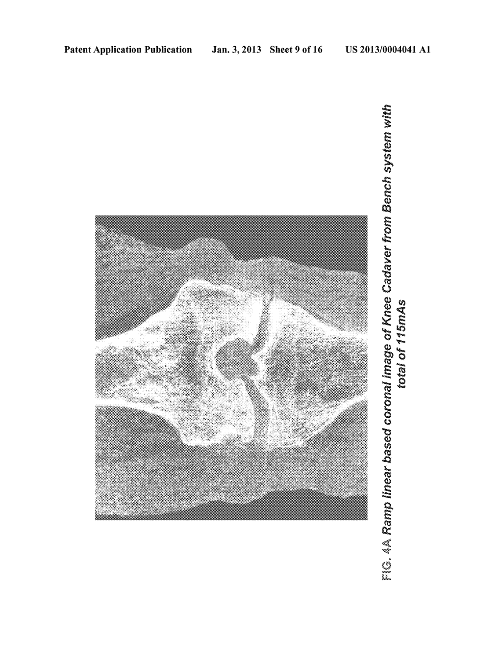 METHODS AND APPARATUS FOR TEXTURE BASED FILTER FUSION FOR CBCT SYSTEM AND     CONE-BEAM IMAGE RECONSTRUCTION - diagram, schematic, and image 10