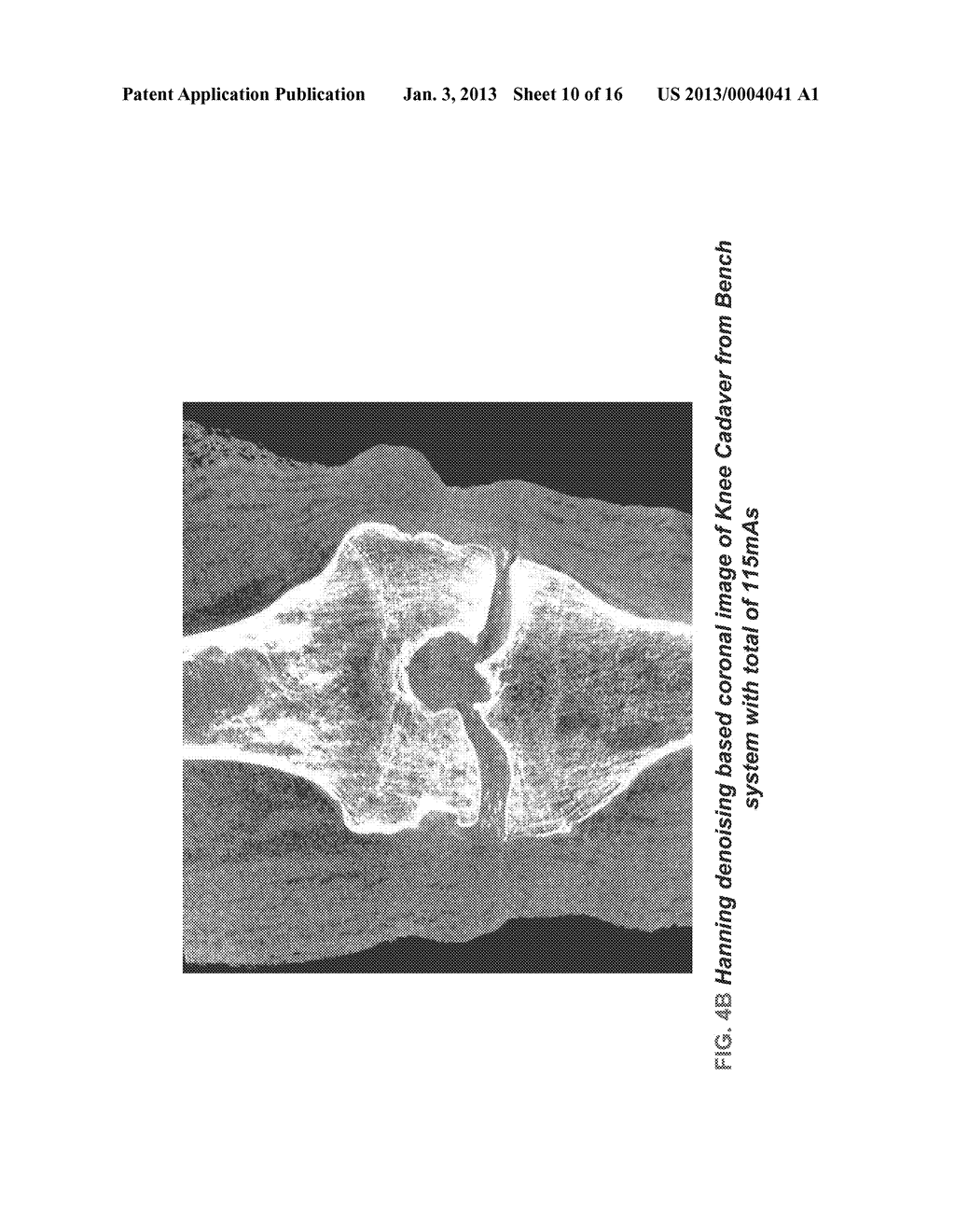 METHODS AND APPARATUS FOR TEXTURE BASED FILTER FUSION FOR CBCT SYSTEM AND     CONE-BEAM IMAGE RECONSTRUCTION - diagram, schematic, and image 11