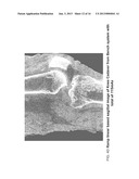 METHODS AND APPARATUS FOR TEXTURE BASED FILTER FUSION FOR CBCT SYSTEM AND     CONE-BEAM IMAGE RECONSTRUCTION diagram and image