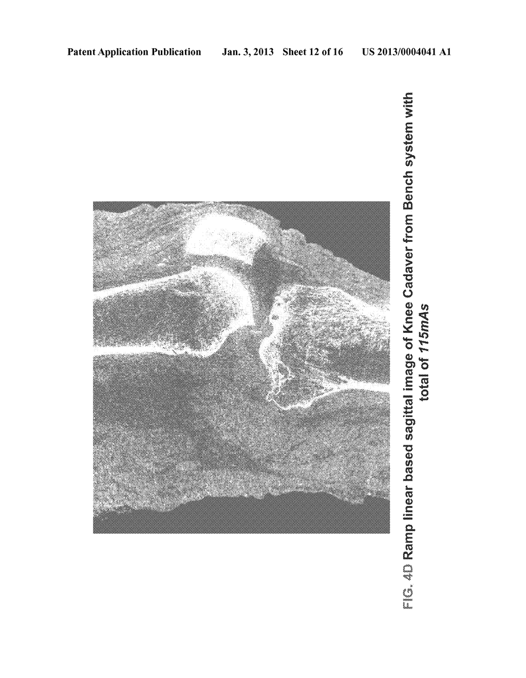 METHODS AND APPARATUS FOR TEXTURE BASED FILTER FUSION FOR CBCT SYSTEM AND     CONE-BEAM IMAGE RECONSTRUCTION - diagram, schematic, and image 13