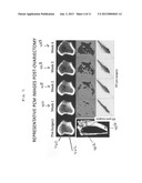 Pixel and Voxel-Based Analysis of Registered Medical Images for Assessing     Bone Integrity diagram and image