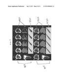 Pixel and Voxel-Based Analysis of Registered Medical Images for Assessing     Bone Integrity diagram and image