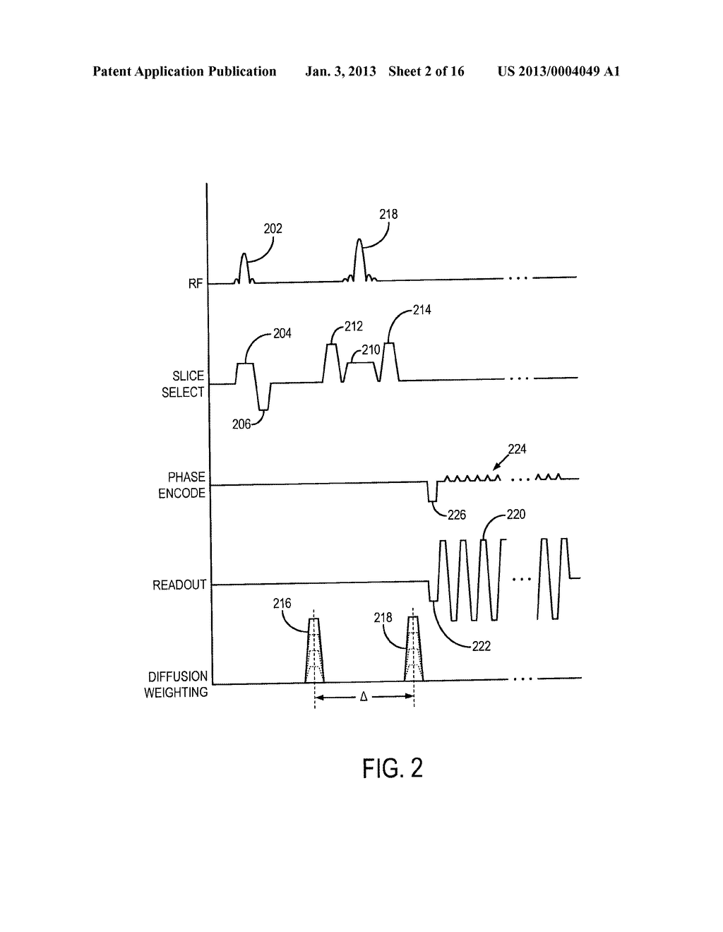 SYSTEMS AND METHODS FOR IMPROVED TRACTOGRAPHIC PROCESSING - diagram, schematic, and image 03