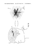 SYSTEMS AND METHODS FOR IMPROVED TRACTOGRAPHIC PROCESSING diagram and image