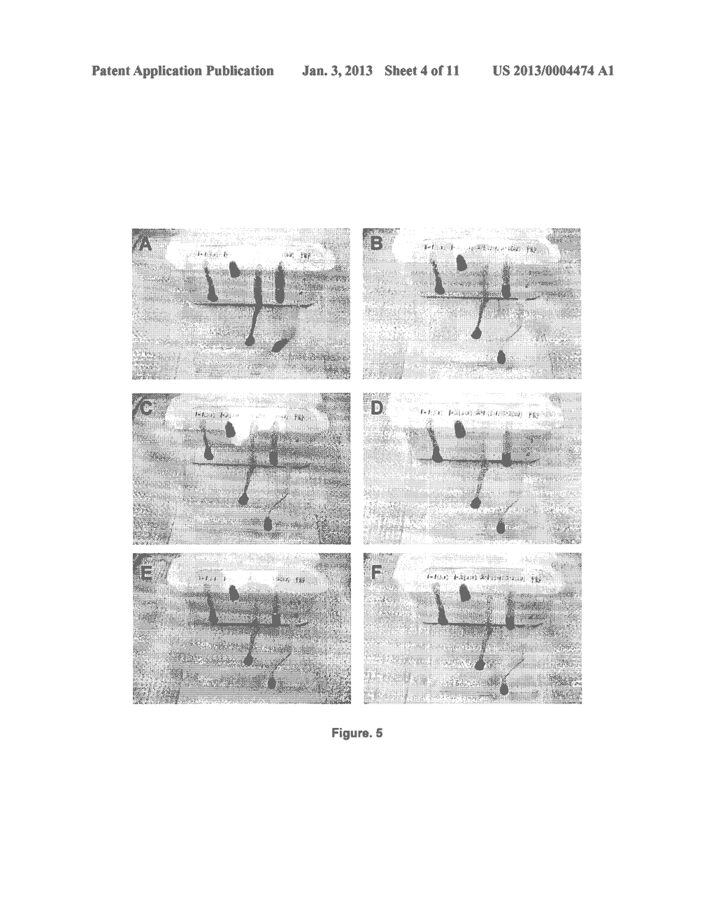 SOLUBLE PHYSIOLOGICAL CHITOSAN FORMULATIONS COMBINED WITH PLATELET-RICH     PLASMA (PRP) FOR TISSUE REPAIR - diagram, schematic, and image 05