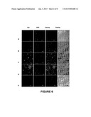 ANTI-CANCER AGENT DELIVERY VEHICLES CAPABLE OF IMPROVED LOADING diagram and image