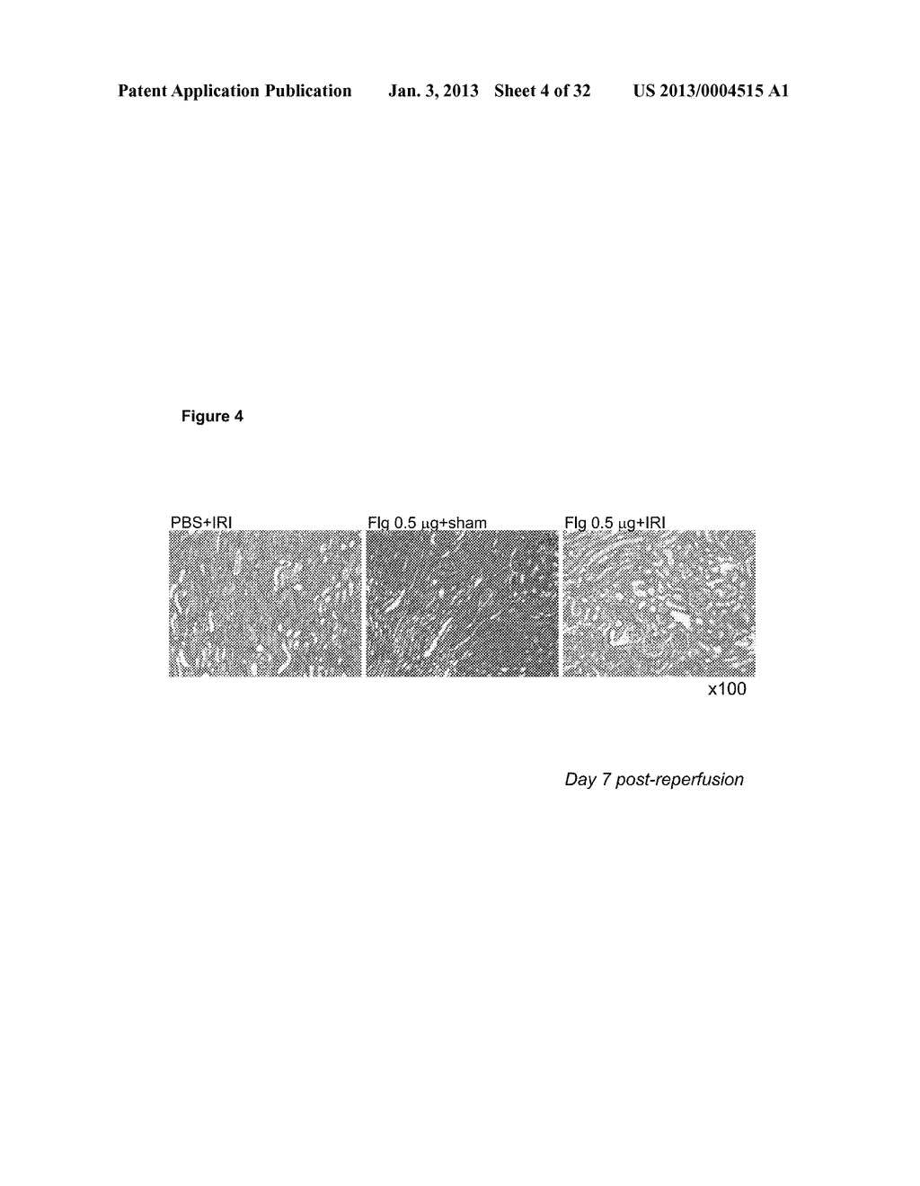 METHODS FOR TREATING REPERFUSION INJURIES - diagram, schematic, and image 05