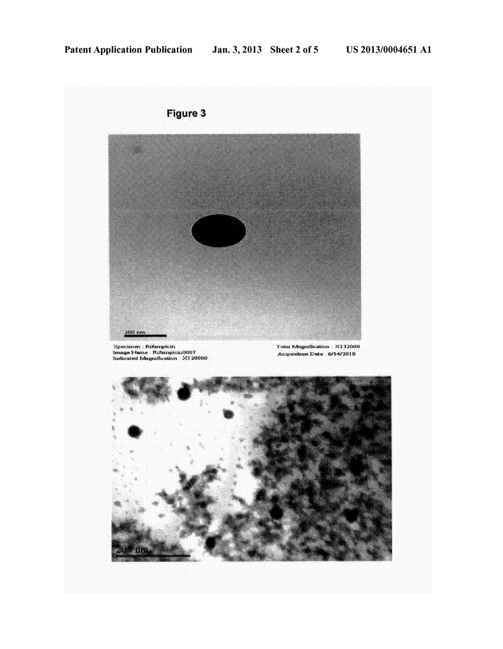 SUSTAINED DRUG RELEASE FROM BODY IMPLANTS USING NANOPARTICLE-EMBEDDED     POLYMERIC COATING MATERIALS - diagram, schematic, and image 03