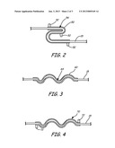 STRAIN RELIEF FEATURE FOR AN IMPLANTABLE MEDICAL DEVICE LEAD diagram and image