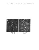 S-NITROSYLATION OF GLUCOSYLATING TOXINS AND USES THEREFOR diagram and image