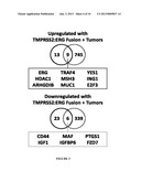 CANCER BIOMARKERS TO PREDICT RECURRENCE AND METASTATIC POTENTIAL diagram and image