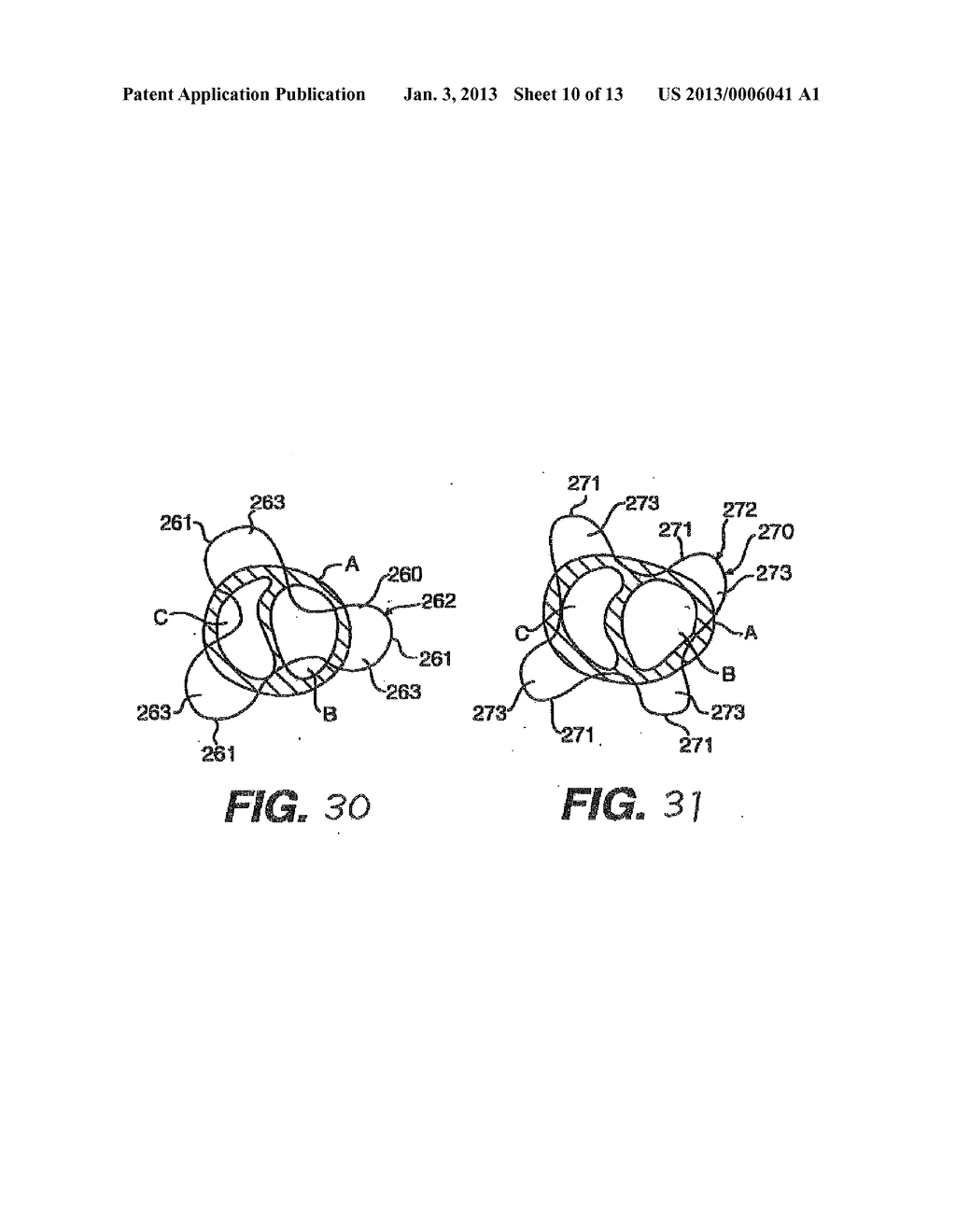 Heart Wall Tension Reduction Apparatus and Method - diagram, schematic, and image 11