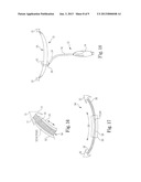 Implantable Sling Systems and Methods diagram and image