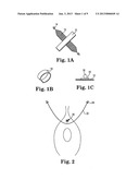 IMPLANTS, TOOLS, AND METHODS FOR TREATMENTS OF PELVIC CONDITIONS diagram and image