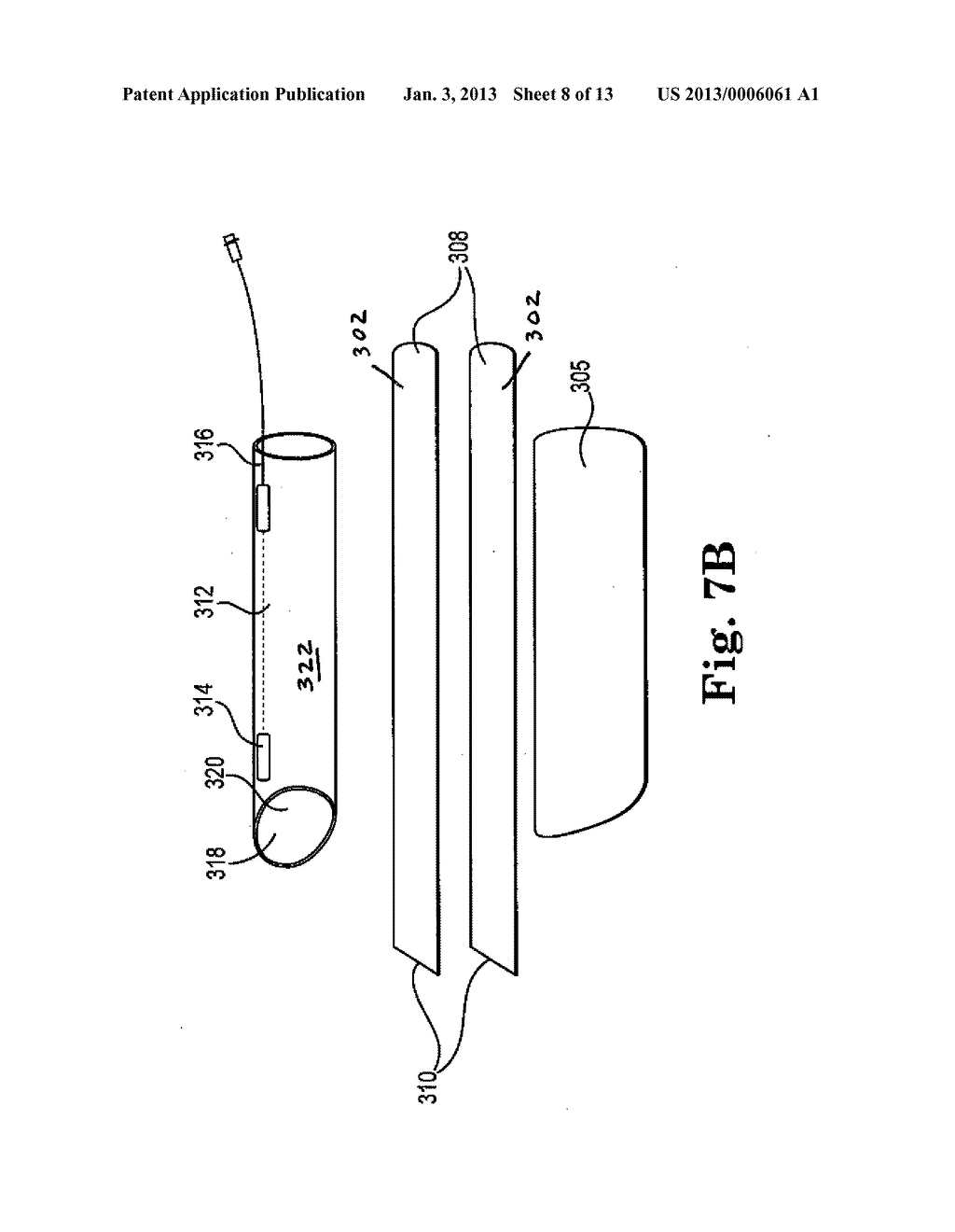 SYSTEMS, IMPLANTS, TOOLS, AND METHODS FOR TREATMENTS OF PELVIC CONDITIONS - diagram, schematic, and image 09