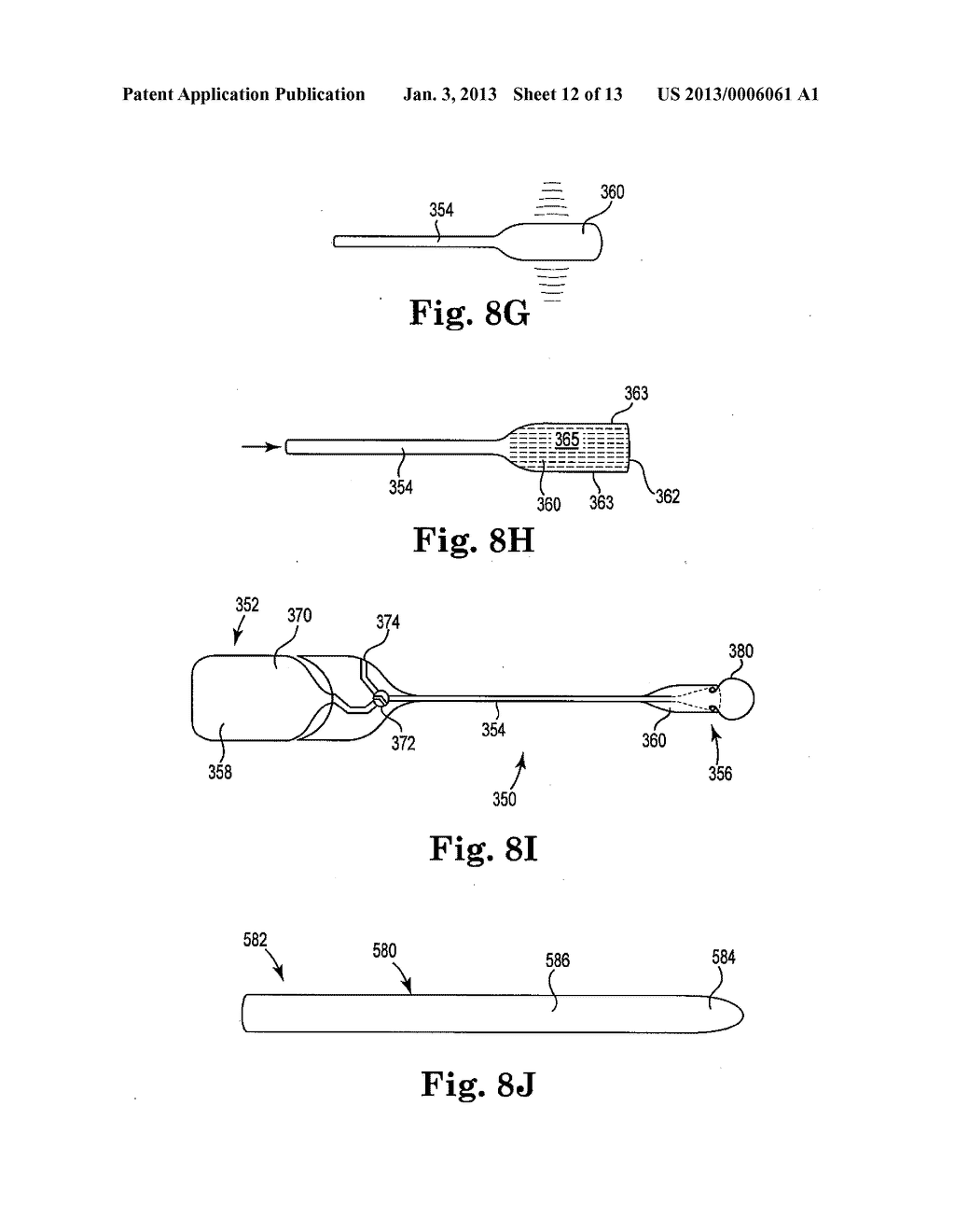 SYSTEMS, IMPLANTS, TOOLS, AND METHODS FOR TREATMENTS OF PELVIC CONDITIONS - diagram, schematic, and image 13