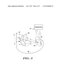 Methods and Devices for Accurately Classifying Cardiac Activity diagram and image