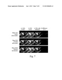 SYSTEM AND METHOD FOR ACCELERATED FOCUSED ULTRASOUND IMAGING diagram and image