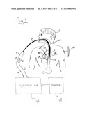 MEDICAL PROBE AND METHOD OF USING SAME diagram and image