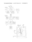 MEDICAL PROBE AND METHOD OF USING SAME diagram and image