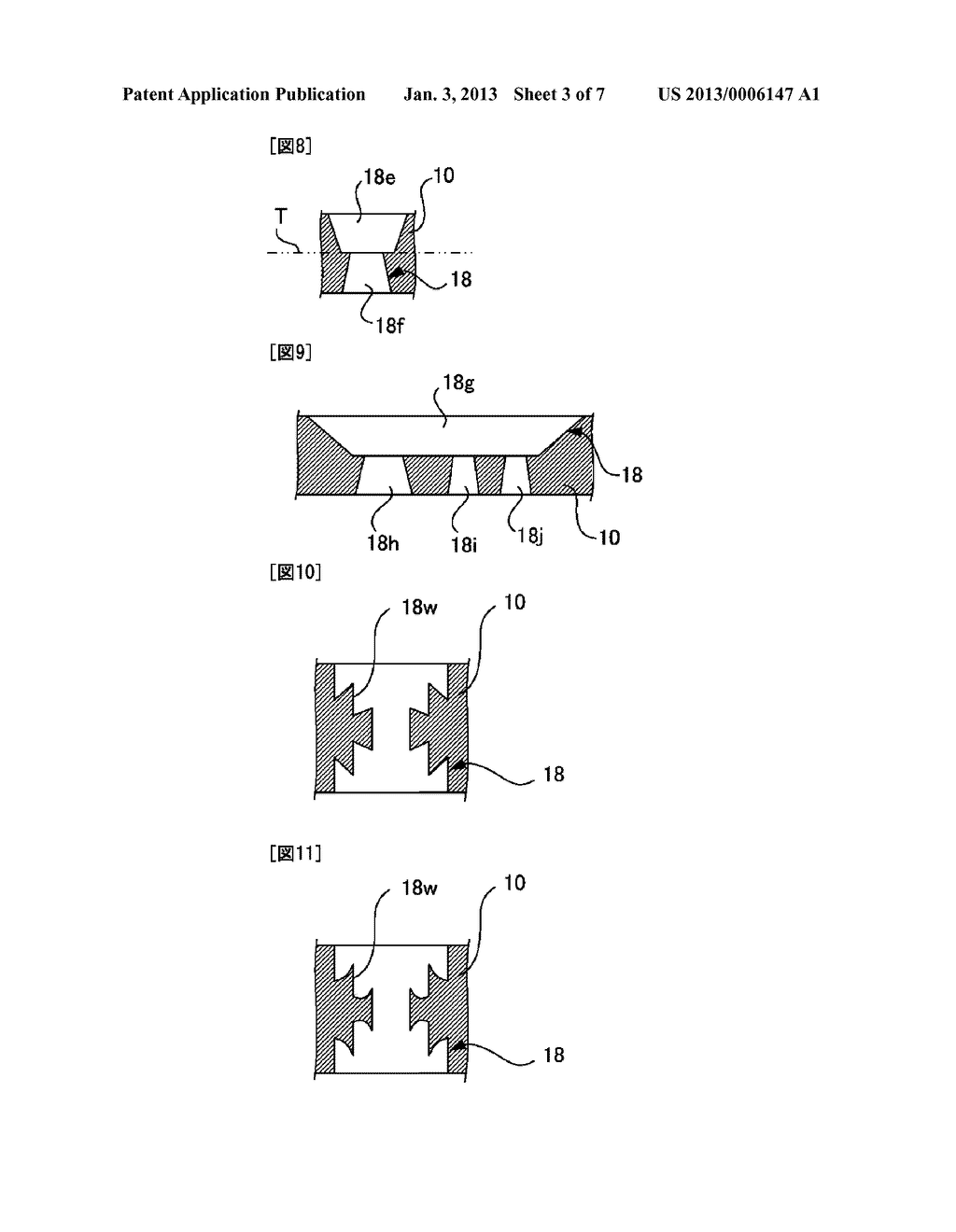 MEDICAL NEEDLE AND PUNCTURING INSTRUMENT - diagram, schematic, and image 04