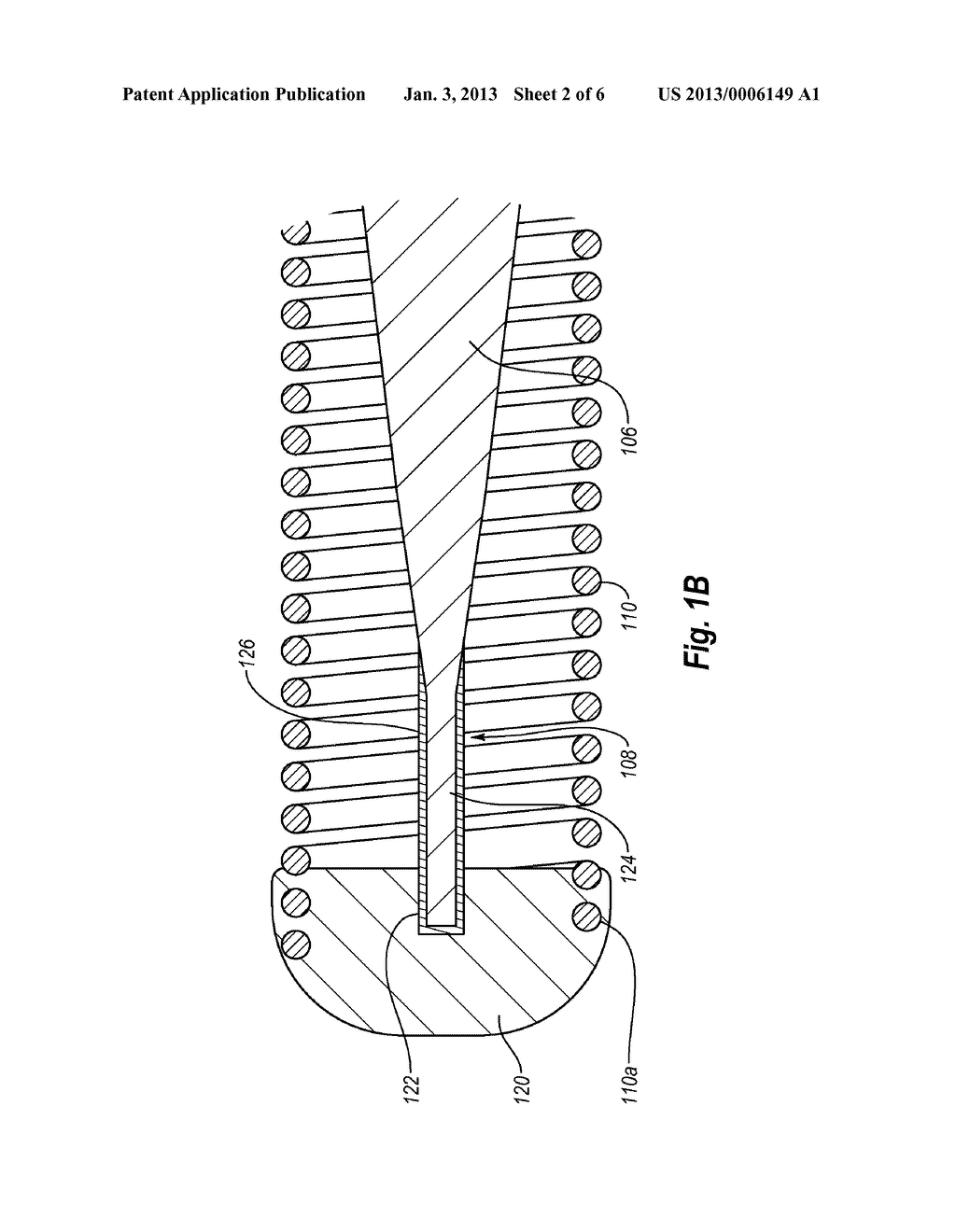 Guide Wire Device Including a Solderable Linear Elastic Nickel-Titanium     Distal End Section and Methods Of Preparation Therefor - diagram, schematic, and image 03