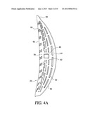 ORTHOPEDIC DEVICE FOR TREATMENT OF THE BACK diagram and image