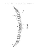 ORTHOPEDIC DEVICE FOR TREATMENT OF THE BACK diagram and image