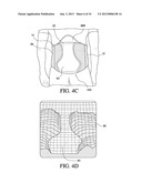 ORTHOPEDIC DEVICE FOR TREATMENT OF THE BACK diagram and image