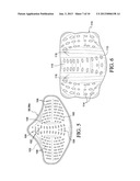 ORTHOPEDIC DEVICE FOR TREATMENT OF THE BACK diagram and image