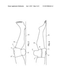 Knee saving device diagram and image