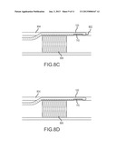 Reentry Catheter and Method Thereof diagram and image